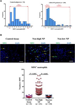 Corrigendum: Characterizing the neutrophilic inflammation in chronic rhinosinusitis with nasal polyps